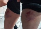 
                1 июня в центре Иркутска собака покусала 10-летнего мальчика
                
            
