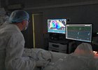 
                Иркутские врачи впервые применили внутрисердечное УЗИ при операциях на сердце
                
            
